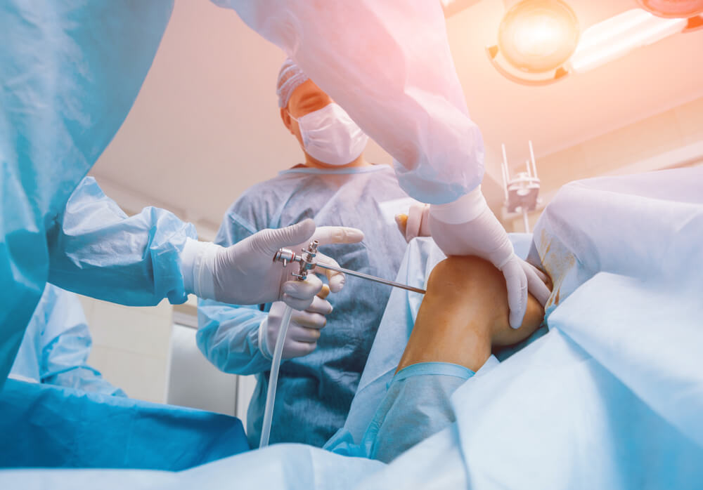 What Happens During A Knee Arthroscopy Dr Jens Buelow